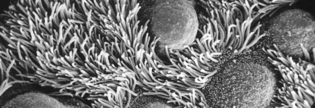 A scanning electron micrograph of cilia in a bronchial wall. The cilia that project from the tops of the epithelial cells help to cleanse the lung by moving trapped particles.