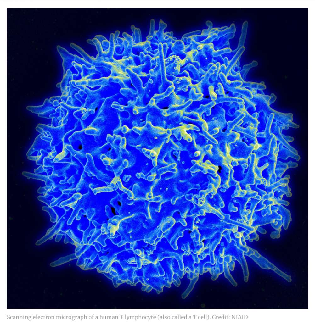 An electron micrograph of a T cell.