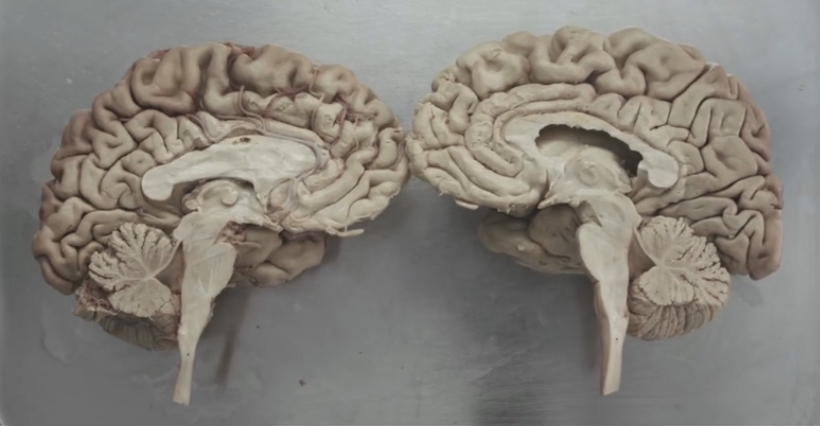 A cross-section model of a human brain.